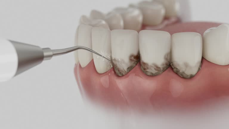 Reliable Dental Implants contractor in Manor, PA by Smile Center Dentistry